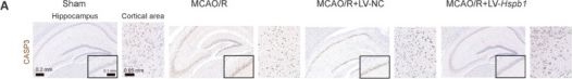 Fig.2.A showing Immunohistochemistry from the publication: Hspb1 inhibits microglial ferroptosis and pro-inflammatory activation to alleviate cerebral ischemia/reperfusion injury in mice.