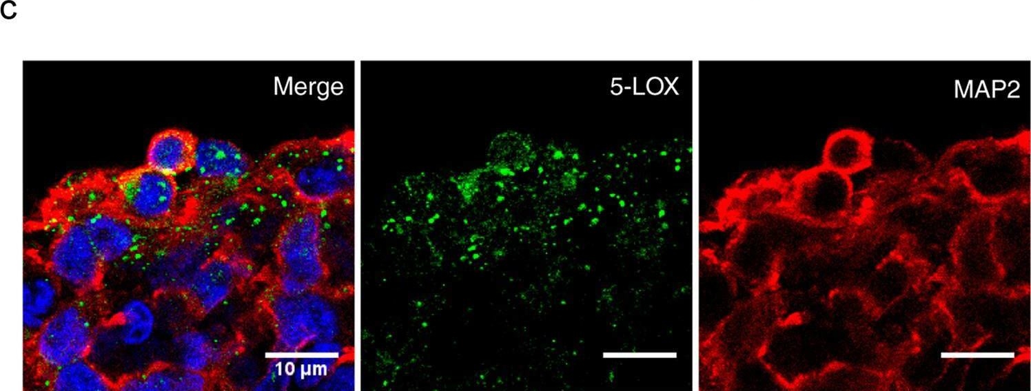 Fig.1.C showing Immunohistochemistry-immunofluorescence in a Homo sapiens (Human) sample from the publication: Age-linked suppression of lipoxin A4 associates with cognitive deficits in mice and humans.