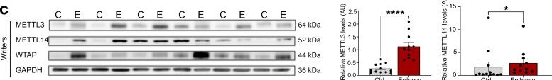 Fig.2.C showing Western Blotting in a Homo sapiens (Human) sample from the publication: N6-methyladenosine (m6A) dysregulation contributes to network excitability in temporal lobe epilepsy.