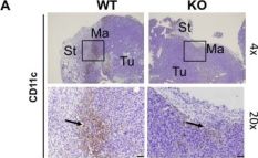 ｒｉｐページ CD11c (D1V9Y) Rabbit Monoclonal Antibody | Cell Signaling Technology