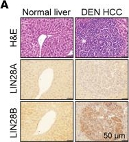 Fig.1.A showing Immunohistochemistry in a Mus musculus (House mouse) sample from the publication: Liver cancer initiation requires translational activation by an oncofetal regulon involving LIN28 proteins.