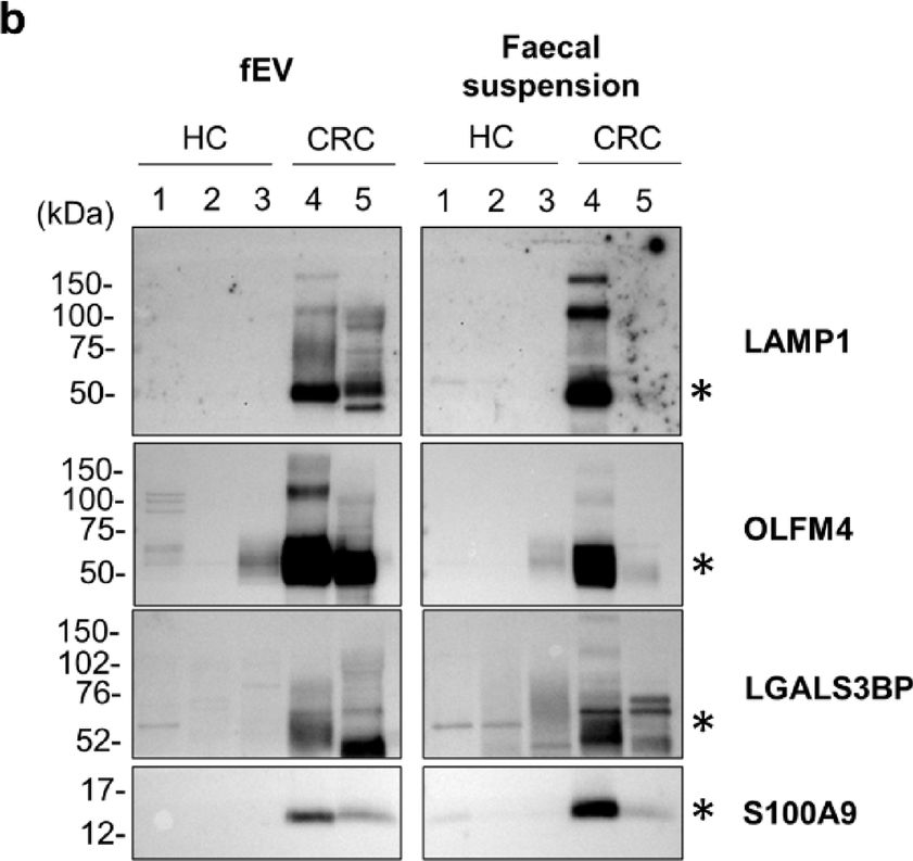 Fig.3.B showing Western Blotting in a Homo sapiens (Human) sample from the publication: Proteomic analysis revealed the potential usefulness of faecal extracellular vesicles in colorectal cancer diagnosis.