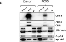 Fig.2.C showing Western Blotting from the publication: Cellular, Extracellular and Extracellular Vesicular miRNA Profiles of Pre-Ovulatory Follicles Indicate Signaling Disturbances in Polycystic Ovaries.