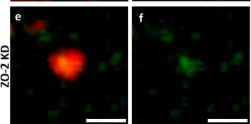 Fig.7.E showing Immunocytochemistry-immunofluorescence from the publication: ZO-2 is a scaffold at the centriole and mitotic spindle poles that enhances microtubule stability and supports the proper development of mitotic spindles and cilia.