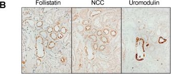 Fig.1.B showing Immunohistochemistry in a Homo sapiens (Human) sample from the publication: Potential Utility of Urinary Follistatin as a Non-Invasive Indicator of Acute Tubular Damage in Patients with Acute Kidney Injury.