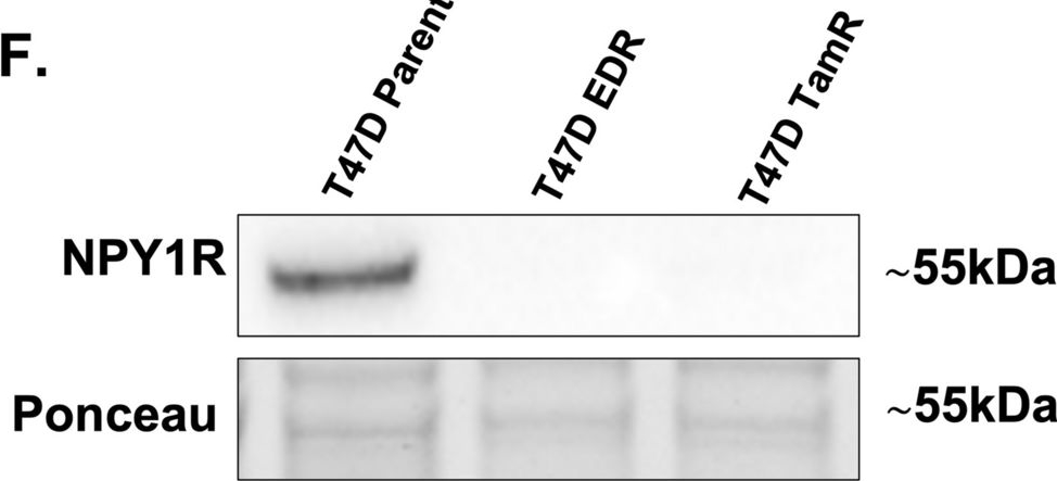 Fig.4.F showing Western Blotting in a Homo sapiens (Human) sample from the publication: NPY1R exerts inhibitory action on estradiol-stimulated growth and predicts endocrine sensitivity and better survival in ER-positive breast cancer.