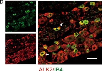 Fig.4.D showing Immunohistochemistry-immunofluorescence from the publication: Growth Differentiation Factor-15 Produces Analgesia by Inhibiting Tetrodotoxin-Resistant Nav1.8 Sodium Channel Activity in Rat Primary Sensory Neurons.