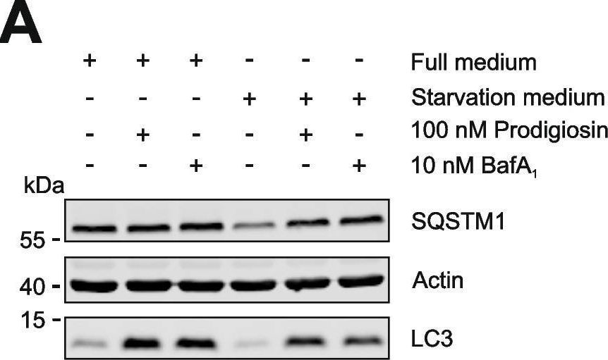 The Golgi stacking protein GRASP55 is targeted by the natural compound prodigiosin.