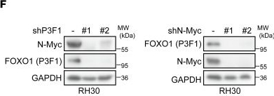 Fig.1.F showing Western Blotting from the publication: Therapeutic targeting of YOD1 disrupts the PAX-FOXO1/N-Myc feedback loop in rhabdomyosarcoma.