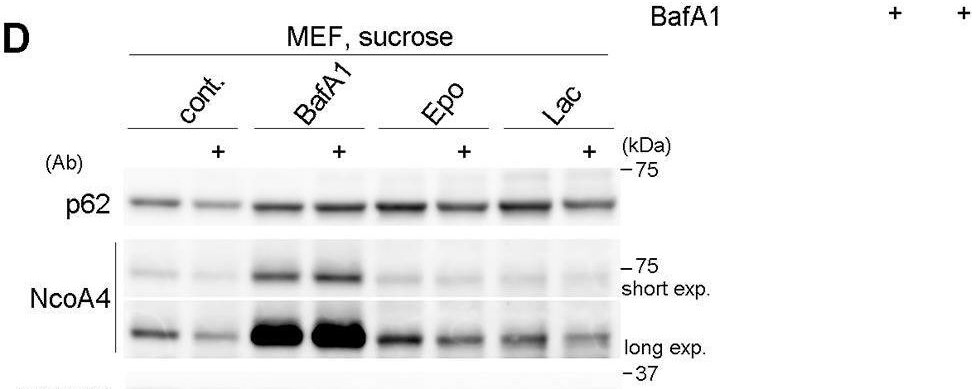 Hyperosmotic Stress Induces Unconventional Autophagy Independent of the Ulk1 Complex.
