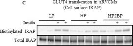 Fig.1.C showing Western Blotting in a Rattus norvegicus (Rat) sample from the publication: Lipid-induced S-palmitoylation of Insulin-Responsive Aminopeptidase (IRAP) drives the onset of insulin resistance in the heart.