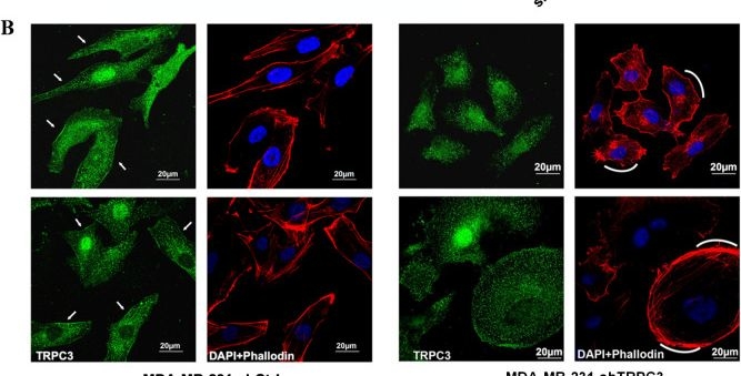 Fig.3.B showing Immunocytochemistry-immunofluorescence in a Homo sapiens (Human) sample from the publication: TRPC3-mediated NFATc1 calcium signaling promotes triple negative breast cancer migration through regulating glypican-6 and focal adhesion.