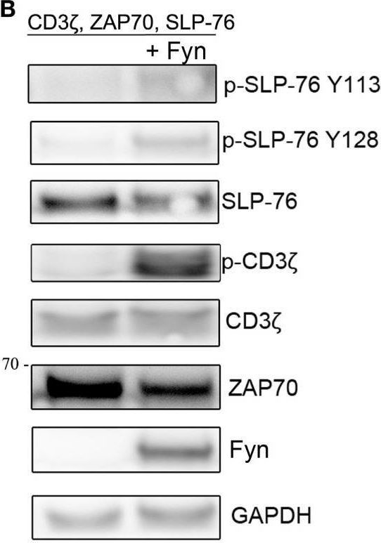 Fig.4.B showing Western Blotting from the publication: Differential Requirements for Src-Family Kinases in SYK or ZAP70-Mediated SLP-76 Phosphorylation in Lymphocytes.