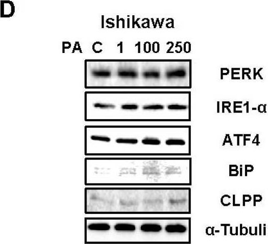 Fig.3.D showing Western Blotting in a Homo sapiens (Human) sample from the publication: Palmitic Acid Exerts Anti-Tumorigenic Activities by Modulating Cellular Stress and Lipid Droplet Formation in Endometrial Cancer.