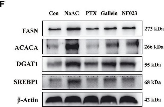 Fig.4.F showing Western Blotting from the publication: Sodium acetate regulates milk fat synthesis through the activation of GPR41/GPR43 signaling pathway.