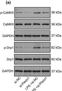 Fig.5.A showing Western Blotting from the publication: Piezo1 exacerbates inflammation-induced cartilaginous endplate degeneration by activating mitochondrial fission via the Ca2+/CaMKII/Drp1 axis.