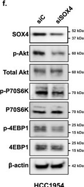 Fig.1.F showing Western Blotting from the publication: SOX4 and SMARCA4 cooperatively regulate PI3k signaling through transcriptional activation of TGFBR2.