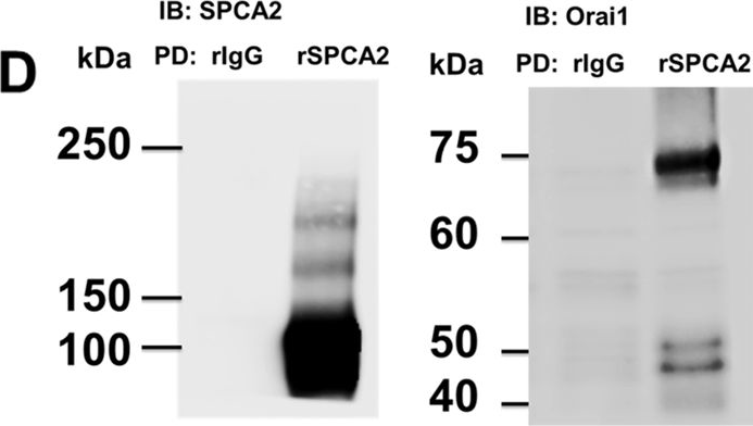 Fig.1.D showing Western Blotting in a Mus musculus (House mouse) sample from the publication: SPCA2 regulates Orai1 trafficking and store independent Ca2+ entry in a model of lactation.
