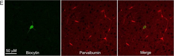 Fig.1.E showing Immunohistochemistry-immunofluorescence in a Rattus norvegicus (Rat) sample from the publication: Nicotinic Modulation of Fast-Spiking Neurons in Rat Somatosensory Cortex across Development.