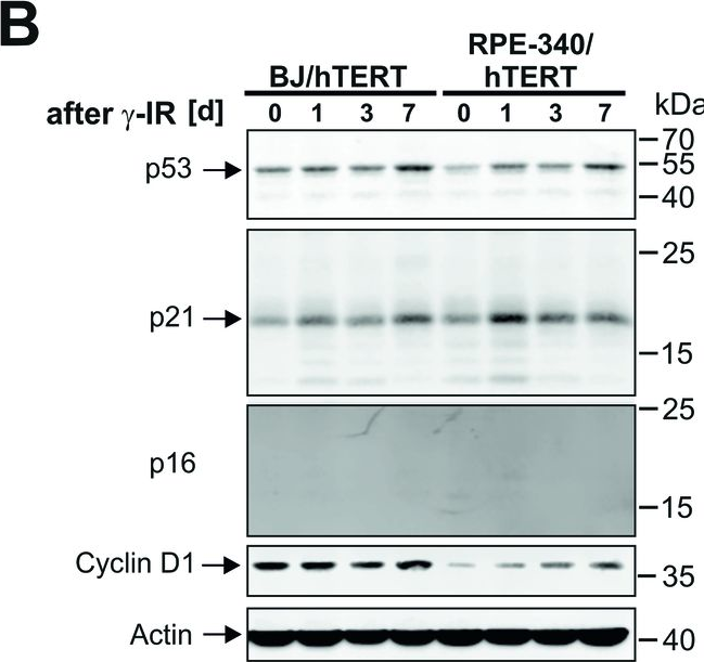 Fig.8.B showing Western Blotting from the publication: Combined inhibition of class 1-PI3K-alpha and delta isoforms causes senolysis by inducing p21WAF1/CIP1 proteasomal degradation in senescent cells.