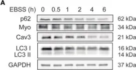 Fig.1.A showing Western Blotting in a Mus musculus (House mouse) sample from the publication: Polycystin-2 Is Required for Starvation- and Rapamycin-Induced Atrophy in Myotubes.