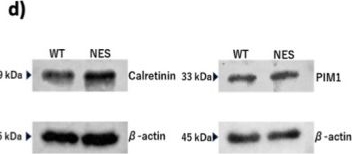 Fig.4.D showing Western Blotting in a Homo sapiens (Human) sample from the publication: Cytoplasmic HuR Expression Enhances Chemoresistance in Pleural Mesothelioma Through Increased Expression of CALB2, Promotion of the E2F Pathway, and Suppression of the p53 Pathway.