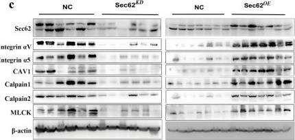 Fig.4.C showing Western Blotting in a Mus musculus (House mouse) sample from the publication: Sec62 promotes early recurrence of hepatocellular carcinoma through activating integrinα/CAV1 signalling.