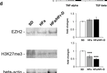 Fig.1.D showing Western Blotting from the publication: EZH2 down-regulation exacerbates lipid accumulation and inflammation in in vitro and in vivo NAFLD.