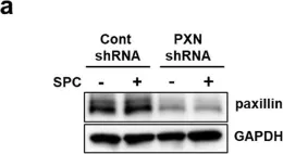 Fig.1.A showing Western Blotting from the publication: Paxillin participates in the sphingosylphosphorylcholine-induced abnormal contraction of vascular smooth muscle by regulating Rho-kinase activation.