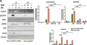 Fig.7.B showing Western Blotting from the publication: RIZ2 at the crossroad of the EGF/EGFR signaling in colorectal cancer.