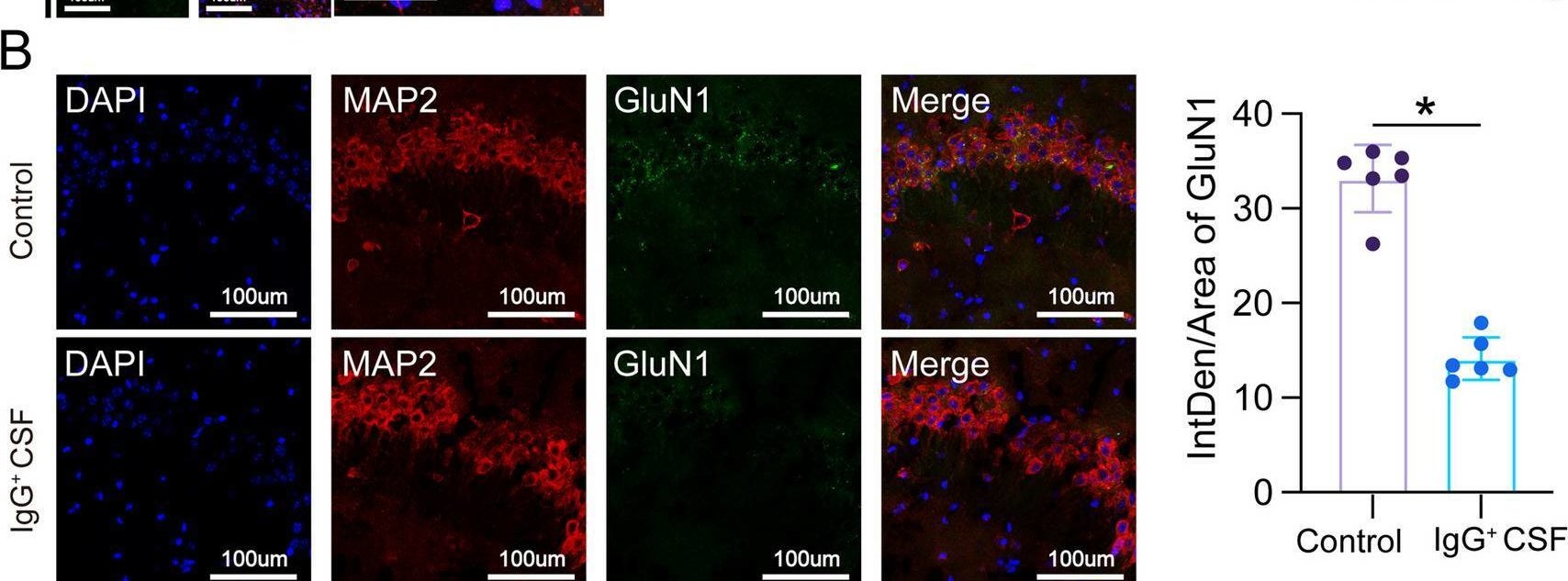 Fig.1.B showing Immunohistochemistry-immunofluorescence in a Mus musculus (House mouse) sample from the publication: Exploring the neuroprotective role of artesunate in mouse models of anti-NMDAR encephalitis: insights from molecular mechanisms and transmission electron microscopy.