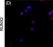 Fig.2.D showing Immunocytochemistry-immunofluorescence in a Homo sapiens (Human) sample from the publication: Alterations of bone proteins in medication-related osteonecrosis of the jaw.