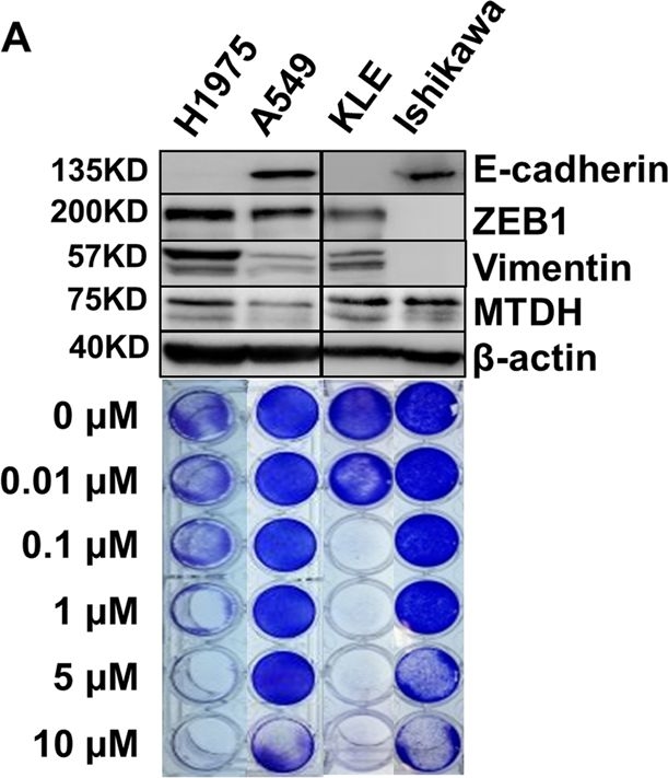 Fig.1.D showing Western Blotting in a Homo sapiens (Human) sample from the publication: Metadherin enhances vulnerability of cancer cells to ferroptosis.