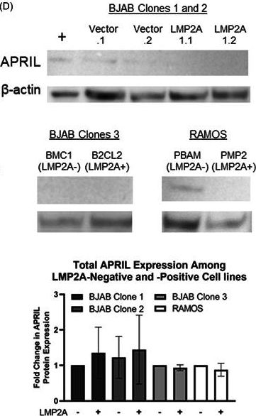 Fig.1.D showing Western Blotting in a Homo sapiens (Human) sample from the publication: The impact of Epstein-Barr virus latent membrane protein 2A on the production of B cell activating factor of the tumor necrosis factor family (BAFF), APRIL and their receptors.
