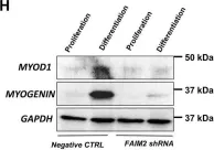 Fig.5.H showing Western Blotting from the publication: Antiapoptotic Protein FAIM2 is targeted by miR-3202, and DUX4 via TRIM21, leading to cell death and defective myogenesis.