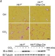 Fig.4.D showing Immunohistochemistry from the publication: HK1 from hepatic stellate cell-derived extracellular vesicles promotes progression of hepatocellular carcinoma.