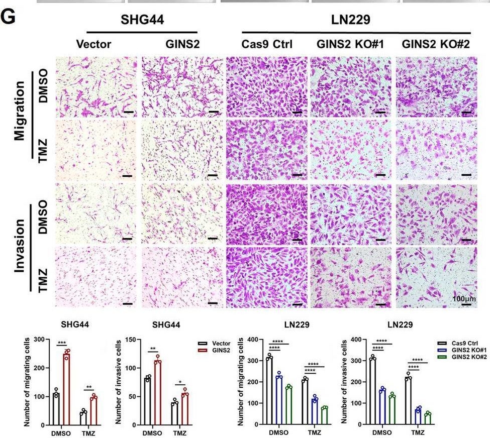 Fig.1.G showing Immunohistochemistry from the publication: GINS2 regulates temozolomide chemosensitivity via the EGR1/ECT2 axis in gliomas.