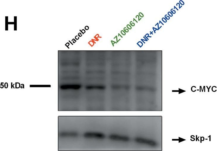 Fig.6.H showing Western Blotting in a Homo sapiens (Human) sample from the publication: Differential sensitivity of acute myeloid leukemia cells to daunorubicin depends on P2X7A versus P2X7B receptor expression.