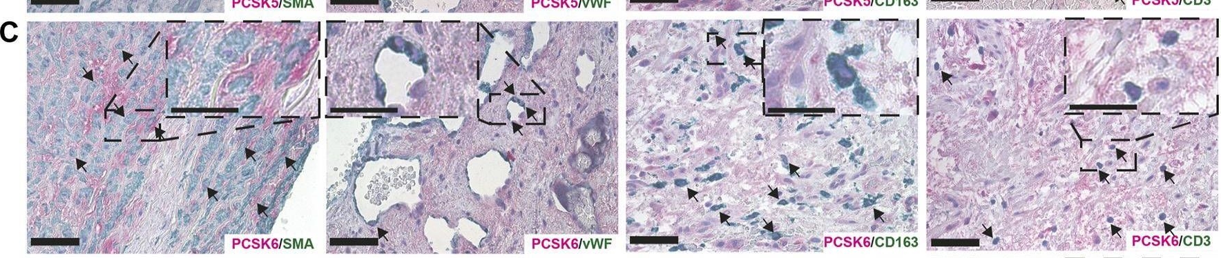 Fig.6.C showing Immunohistochemistry from the publication: Therapeutic potential of the Proprotein Convertase Subtilisin/Kexin family in vascular disease.