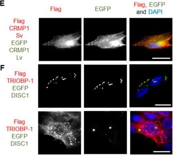 Fig.5.E showing Immunocytochemistry-immunofluorescence from the publication: Co-Aggregation and Parallel Aggregation of Specific Proteins in Major Mental Illness.