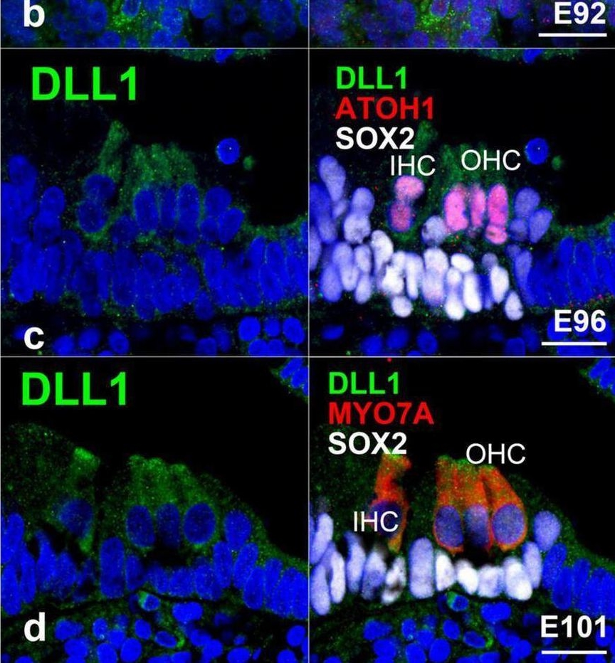 Fig.7.B showing Immunohistochemistry-immunofluorescence in a Callithrix jacchus (Common marmoset) sample from the publication: Mapping of Notch signaling in the developing organ of Corti in common marmosets.