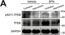 Phospho-TFEB (Ser211) (E9S8N) Rabbit mAb | Cell Signaling Technology