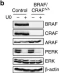 Fig.6.B showing Western Blotting in a Homo sapiens (Human) sample from the publication: RAF proteins exert both specific and compensatory functions during tumour progression of NRAS-driven melanoma.