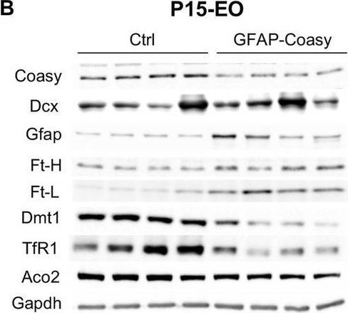 Fig.4.B showing Western Blotting in a Mus musculus (House mouse) sample from the publication: CoA synthase plays a critical role in neurodevelopment and neurodegeneration.