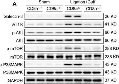 Fig.4.A showing Western Blotting in a Mus musculus (House mouse) sample from the publication: CD8+ T-Cell Deletion Suppressed the Development of Injury-Induced Experimental Neointimal Hyperplasia in Mice With or Without Chronic Stress.
