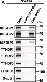 Fig.6.A showing Western Blotting in a Homo sapiens (Human) sample from the publication: METTL16 Promotes Lipid Metabolic Reprogramming and Colorectal Cancer Progression.