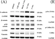 Fig.7.A showing Western Blotting from the publication: Cabazitaxel-Loaded Nanoparticles Reduce the Invasiveness in Metastatic Prostate Cancer Cells: Beyond the Classical Taxane Function.