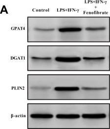 Fig.4.A showing Western Blotting in a Homo sapiens (Human) sample from the publication: Fenofibrate mitigates microglial activation by reprogramming lipid metabolism and inhibiting ferroptosis.