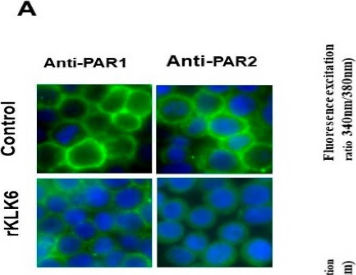 Fig.3.A showing Immunocytochemistry-immunofluorescence from the publication: Kallikrein-Related Peptidase 6 (KLK6) as a Contributor toward an Aggressive Cancer Cell Phenotype: A Potential Role in Colon Cancer Peritoneal Metastasis.