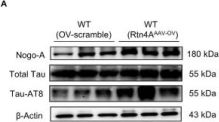 chien様 Tau (D1M9X) XP® Rabbit mAb | Cell Signaling Technology